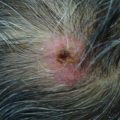 Tender scalp lesion